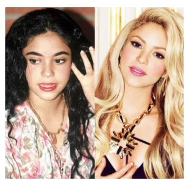 Imagen 5. La cantante Shakira antes y después de ser famosa
