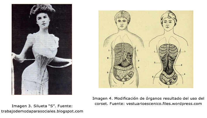 Imagen 3. Silueta "S" e Imagen 4. Modificación de órganos por corset